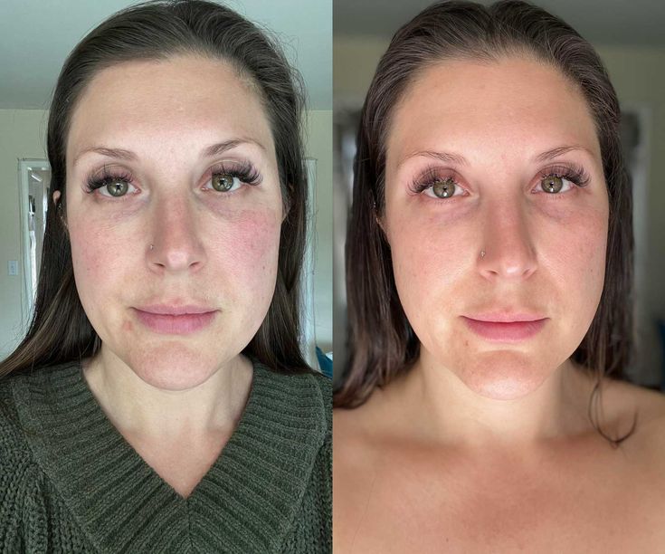 LumaGuard Eye Pro™ Red Light Therapy + EMS