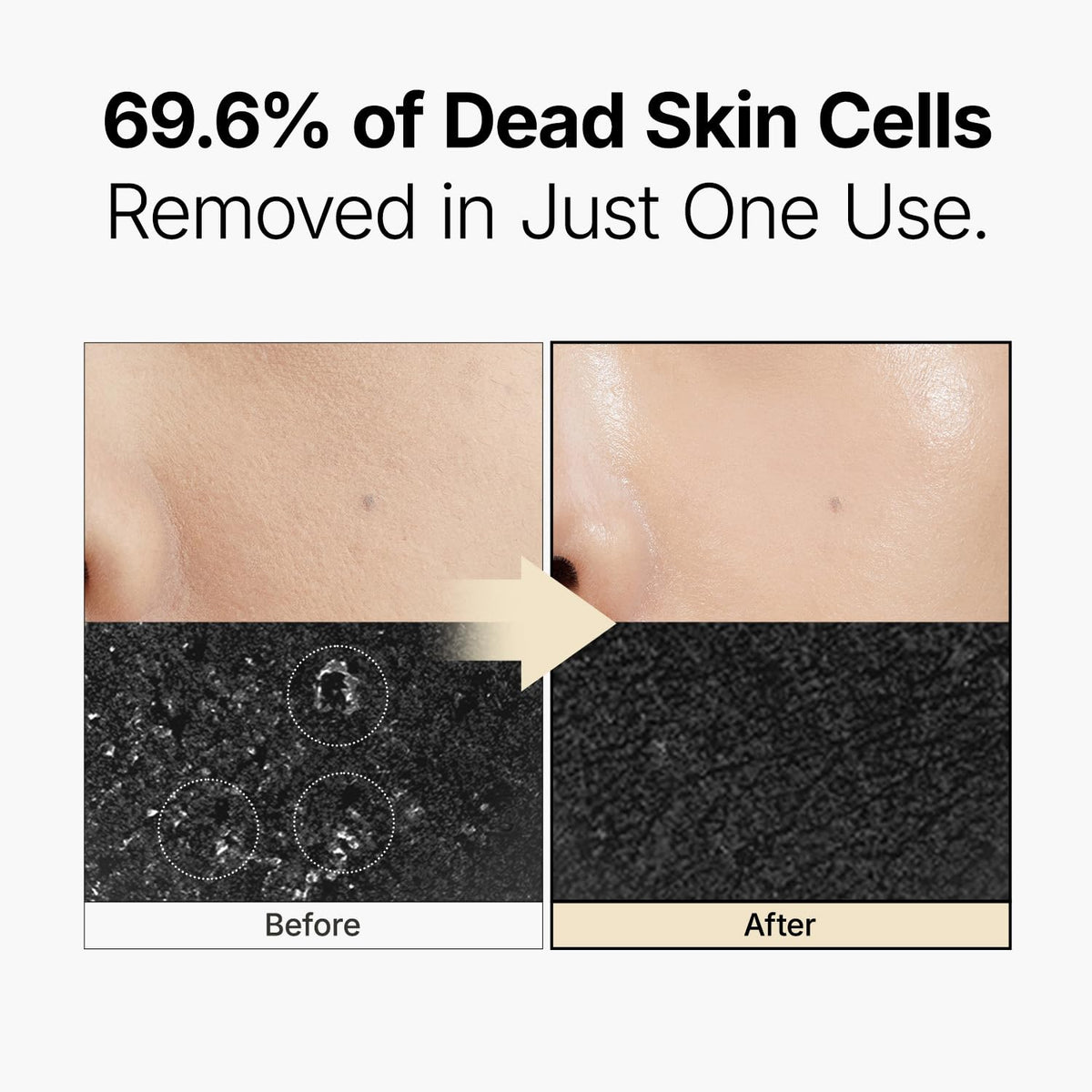 MANYO Galactomy Enzyme Peeling Gel