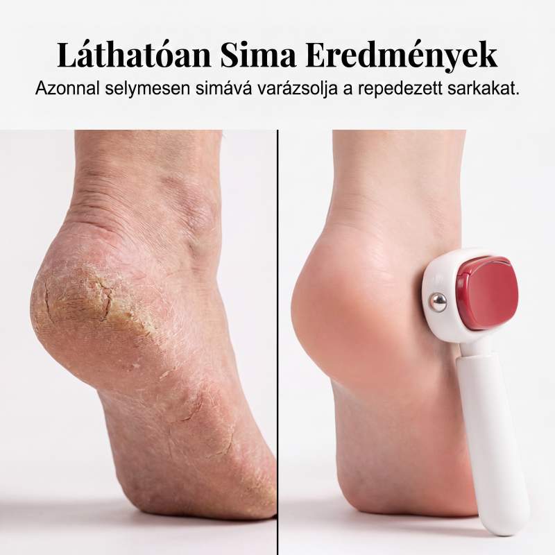 🦶 Double-sided foot scraper for removing calluses.